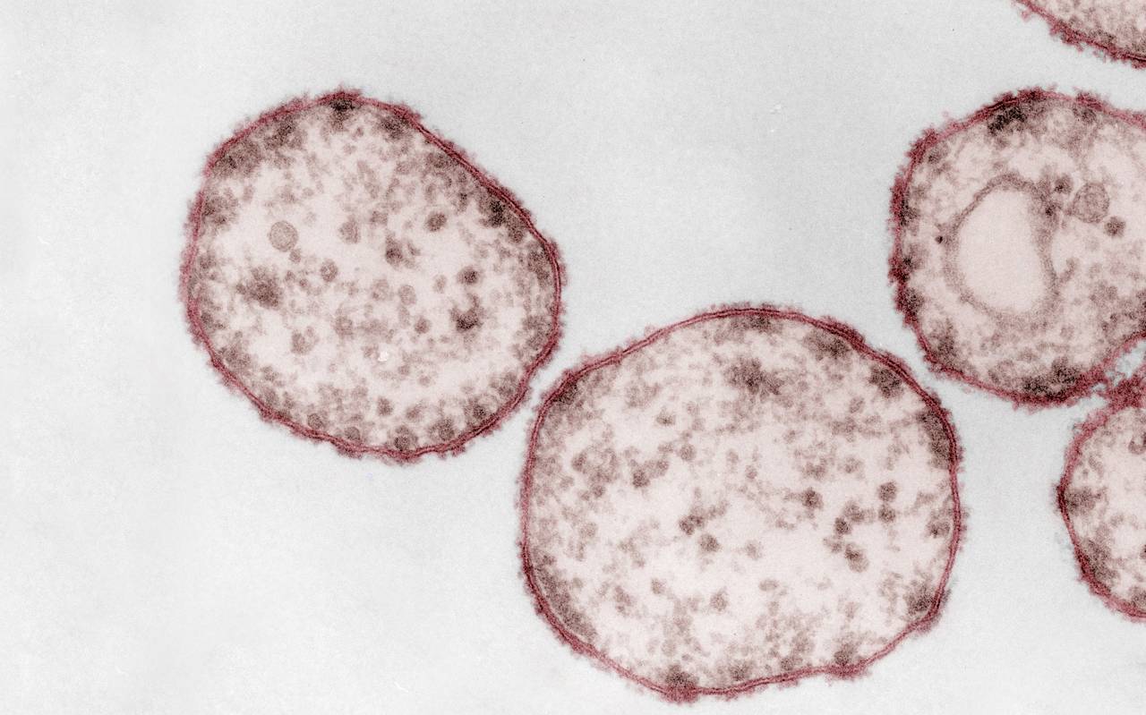 Kolorierte Aufnahme des Masernvirus (Paramyxoviren) unter dem Elektronenmikroskop