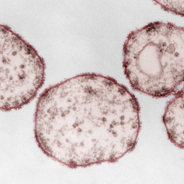 Kolorierte Aufnahme des Masernvirus (Paramyxoviren) unter dem Elektronenmikroskop