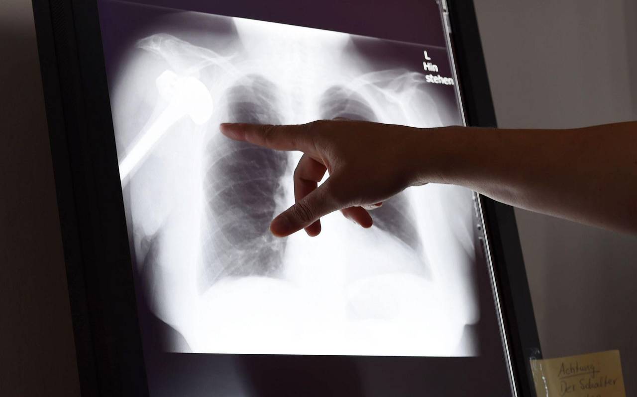 Röntgenbild in Schlichtungsstelle für Arzthaftpflichtfragen
