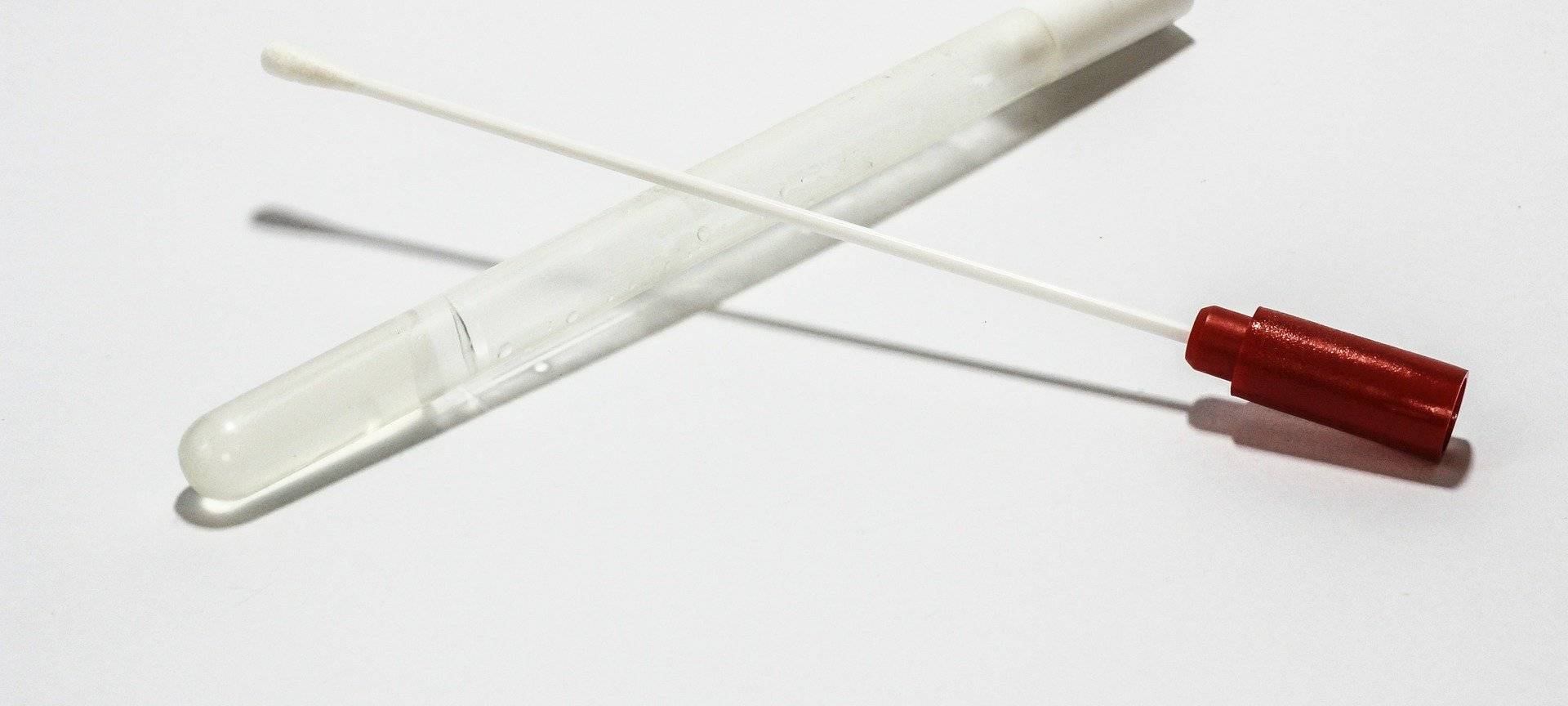 Symbolbild: Abstrichröhrchen