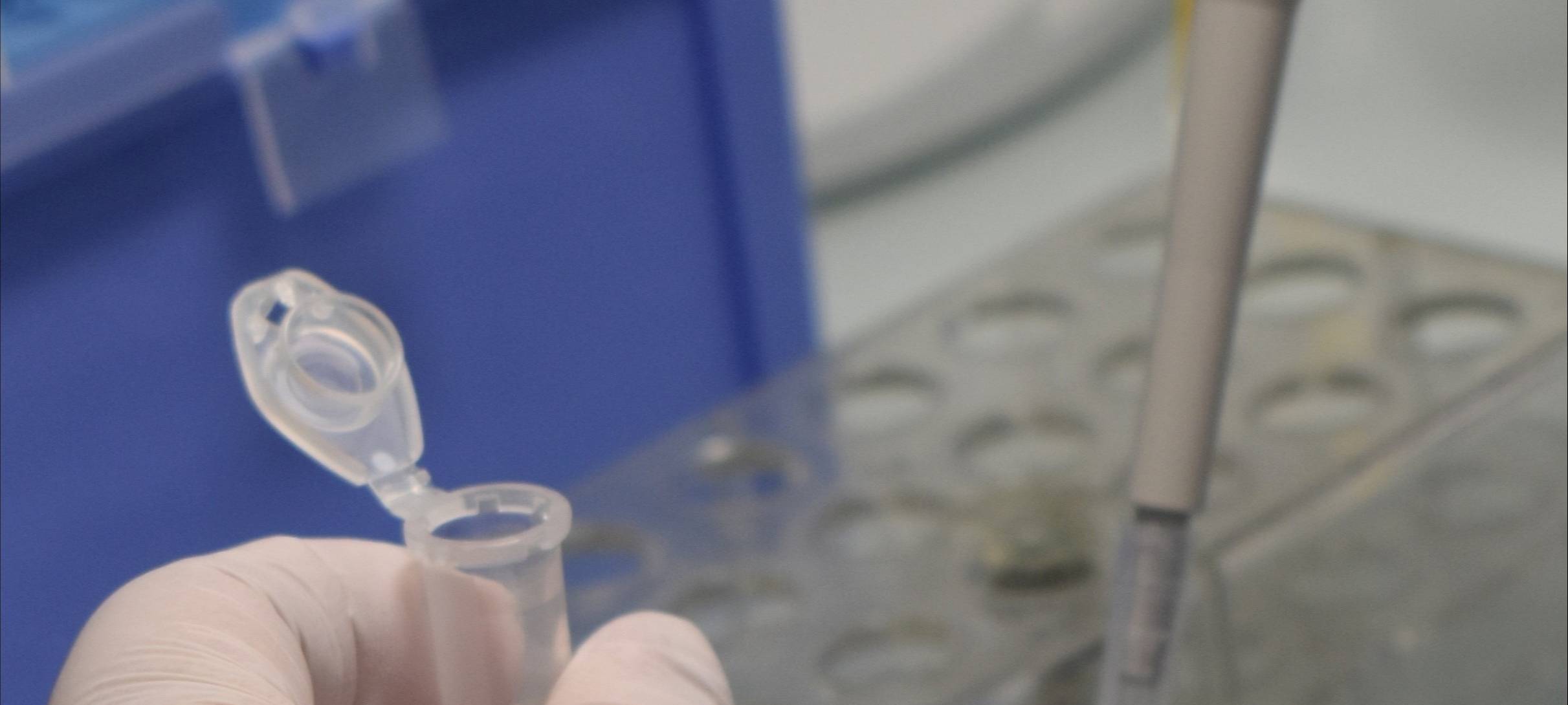 Corona-Testung im Labor des Dortmunder Klinikums.