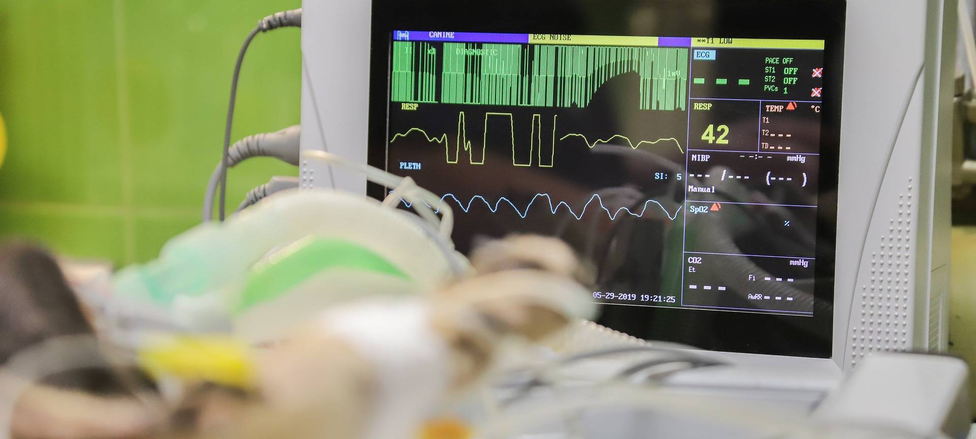 Symbolbild: EKG-Monitor