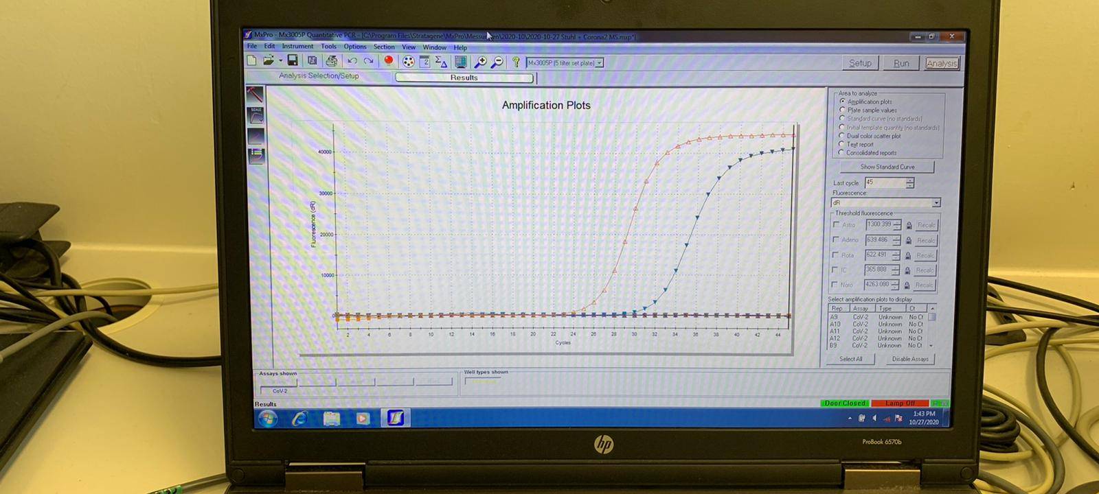 Klinikum Dortmund: Corona-Testung im Labor