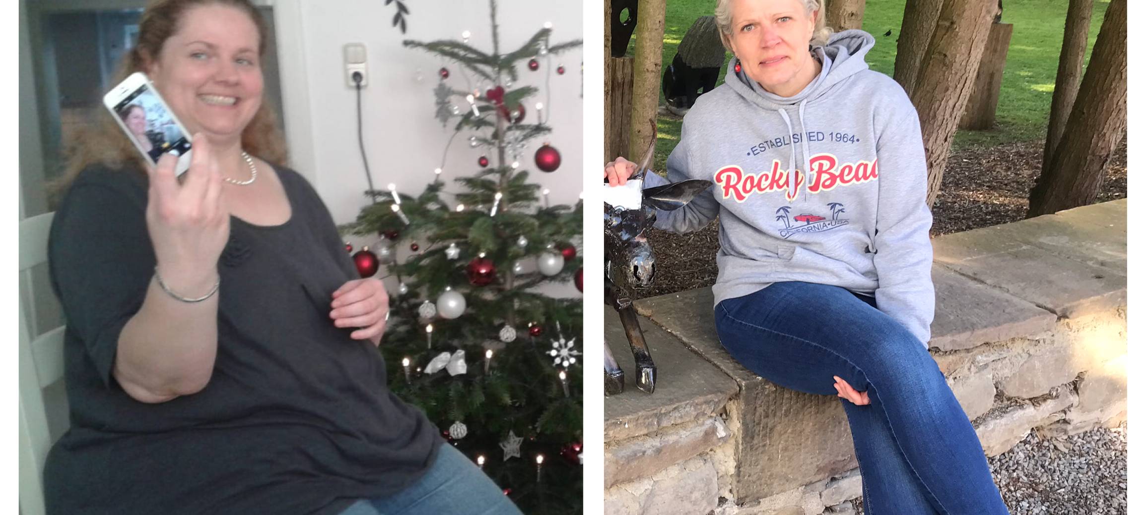 Dortmunderin nimmt 65 Kilo ab