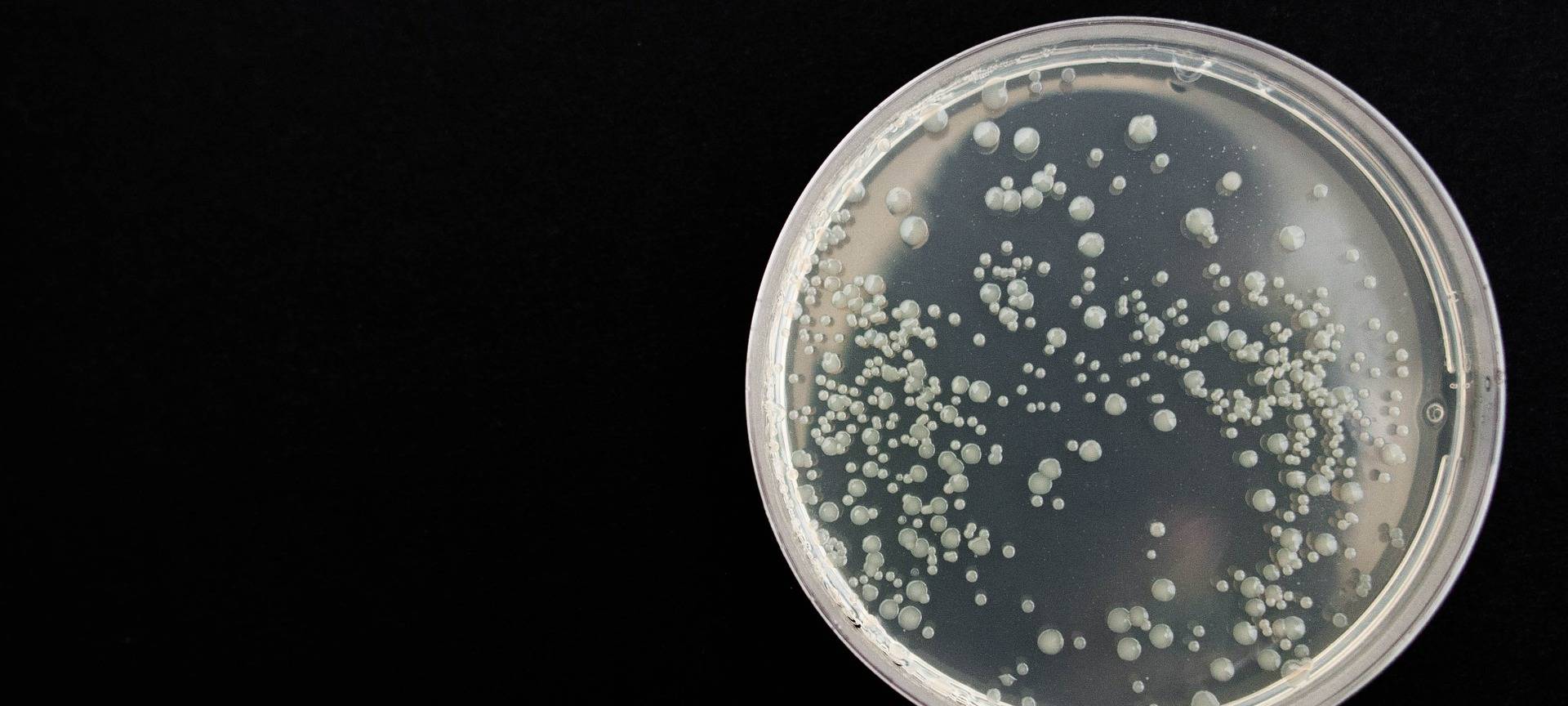 Anstieg der Krätze-Fälle in Dortmund