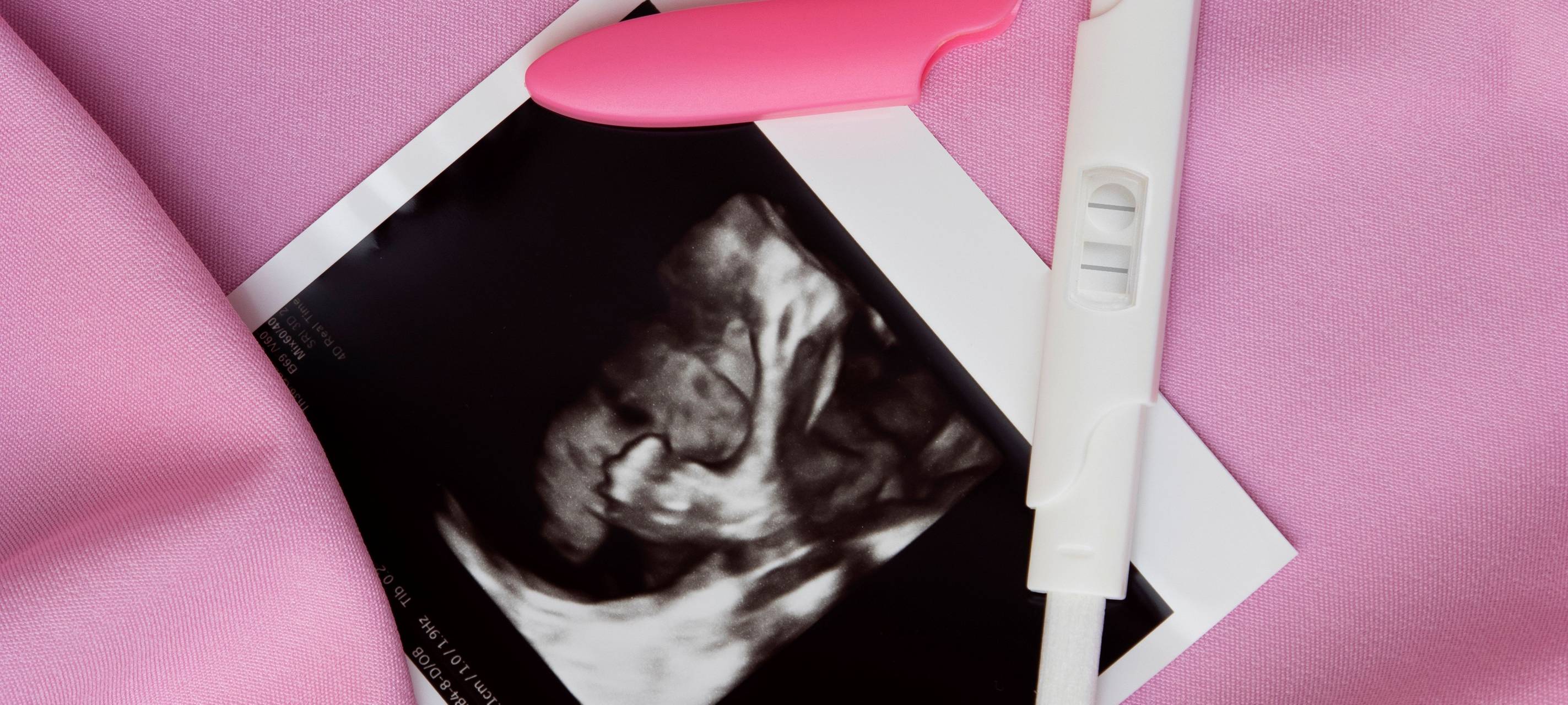 Schwangerschaftstest und Ultraschallbild