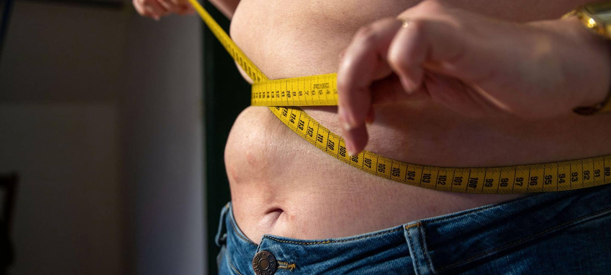 Eine Frau mit Übergewicht hält ein Maßband um ihren Bauch.