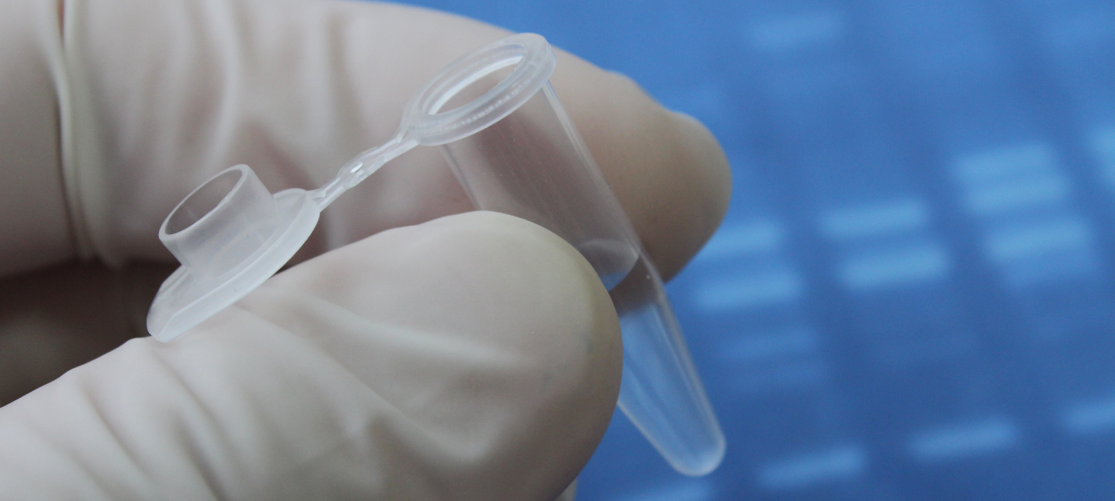 Schalla-Mord: Hautschuppe stammt vom Angeklagten